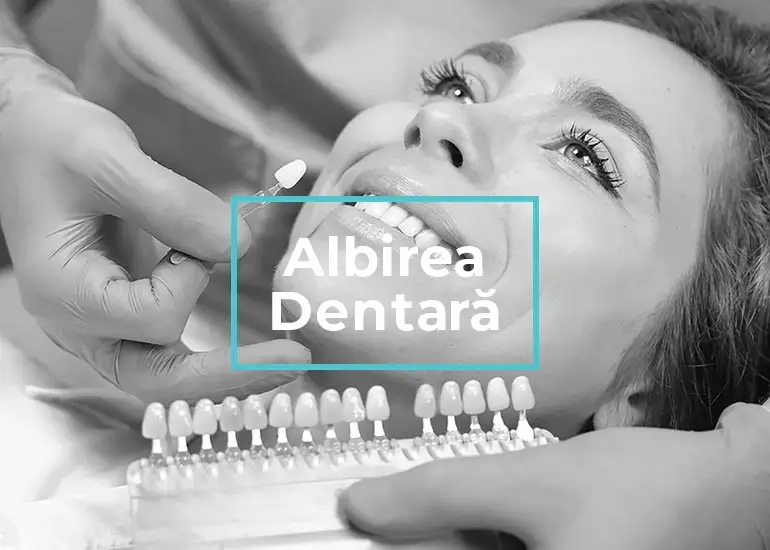 albire dentara târgoviște clinica stomatologica onodent