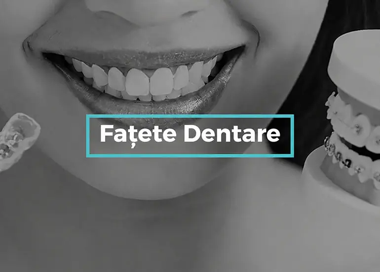 fațete dentare târgoviște
