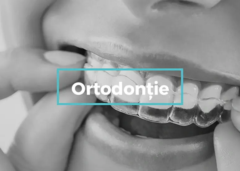 ortodontie târgoviște clinica dentara onodent