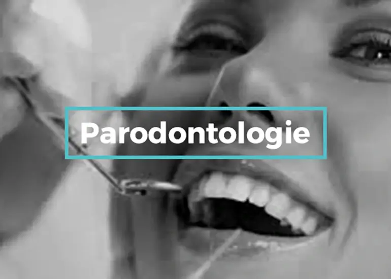 paradontologie târgoviște clinica stomatologica onodent