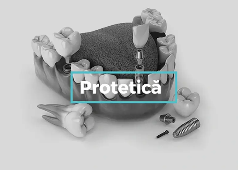 proteza dentara târgoviște clinica stomatologica onodent